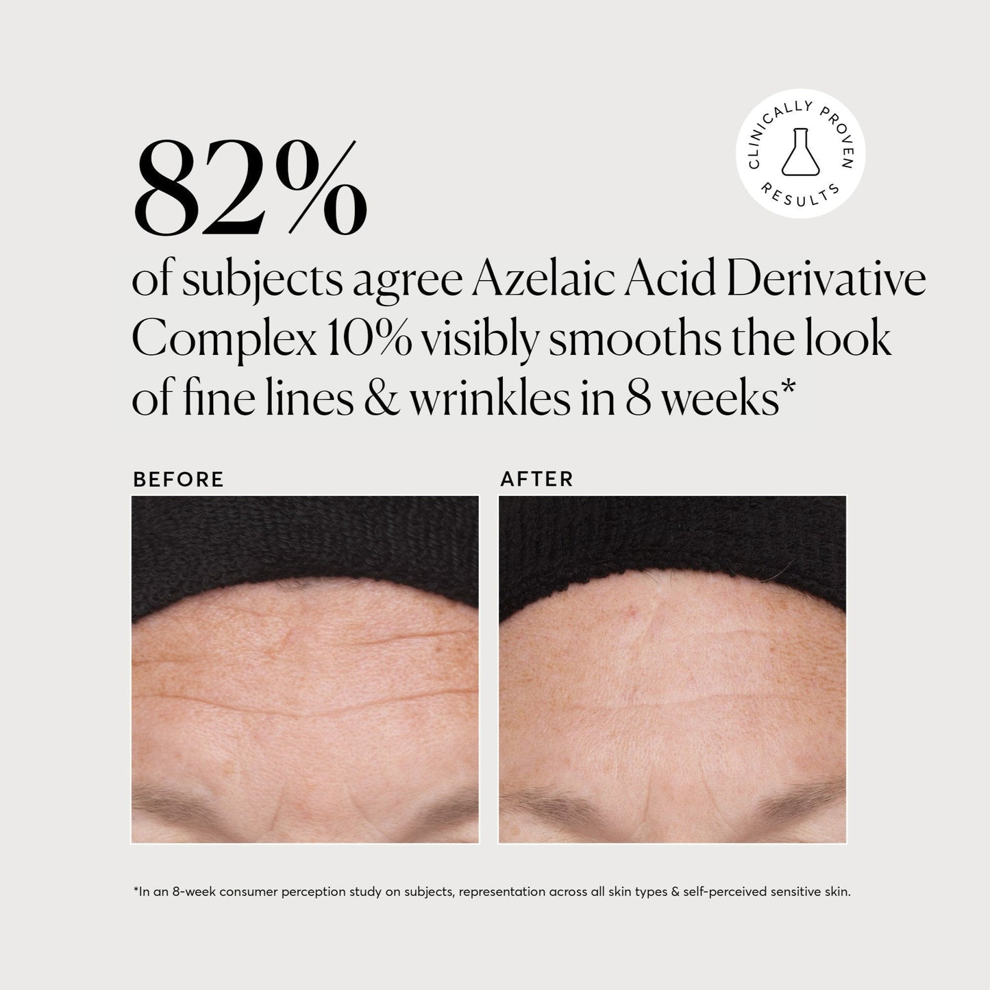 Azelaic Acid Derivative Complex 10%